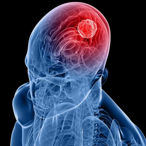Programs & Services | Department of Neurosurgery